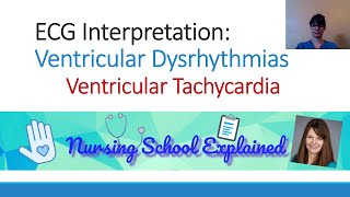 Ventricular Tachycardia VTach [upl. by Umont776]