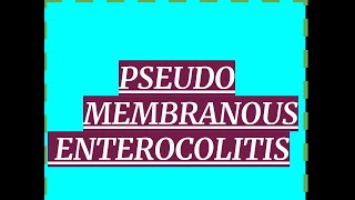 PSEUDO MEMBRANOUS COLITIS [upl. by Nageek]