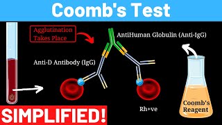 Indirect and direct Antiglobulin test Coombs test  direct and indirect  Panmedicad [upl. by Suzette]