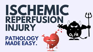 Ischemic Reperfusion Injury Pathology  Explained Simply 2024 [upl. by Euqirne]