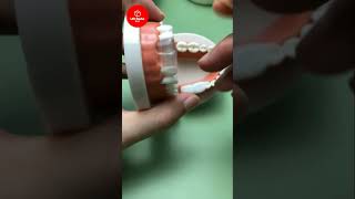 Fix your chipped or broken teeth at home easy DIY TOOTH BONDING  Life Hacks Box [upl. by Pietra594]