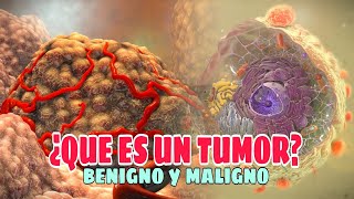 ✅Qué es un TUMOR Tipos Causas Síntomas Tratamiento✅ [upl. by Layor]