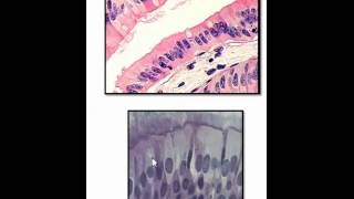 Simple columnar and pseudostratified ciliated columnar epithelium [upl. by Teri645]