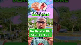 Tes Deteksi Dini Stroke metode Fast Befast Segera Ke RS Waspada Gejala Samar di Otak [upl. by Eciryt323]