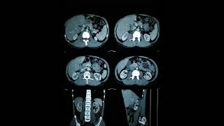 RADIOLOGY EXAM CASES [upl. by Anailil473]