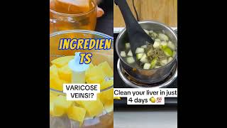 varicose vein removal  how to cleans yourliver [upl. by Ytissac]