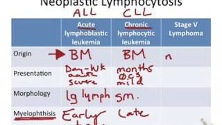 Neoplastic Lymphocytosis [upl. by Carlin]