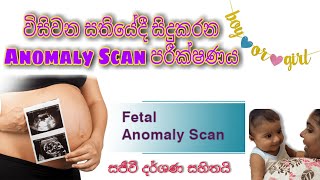 20th Week of Pregnancy  Anomaly Scan  විසිවන සතියදී සිදුකිරිමට නියමිත Anomaly Scan පරික්ශාව [upl. by Noevart]