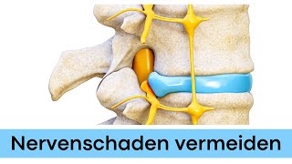 Nervenschaden nach Bandscheibenvorfall LWS [upl. by Keifer]