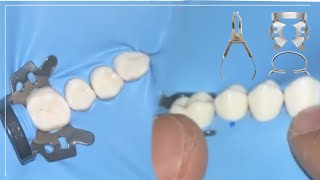 All about Rubber Dam Isolation Demo on posterior and anterior Isolation [upl. by Can223]