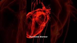 Normal Heart Sound vs Functional Murmur  Auscultation [upl. by Laural273]