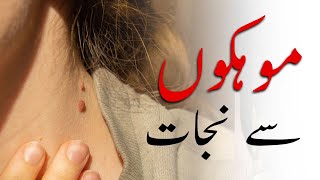 How to Rid Skin Tags and Warts  Remove Skin Tags Quickly  Urdu Hindi [upl. by Nye701]