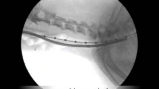 Veterinary Bronchoscopy547 Primary Tracheal Collapse Tracheal Stent Placement [upl. by Dalury]