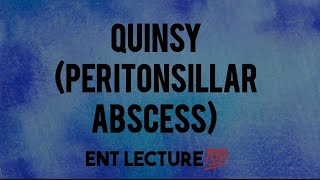 Quinsy lecture  Peritonsillar abcess  Ent lecture [upl. by Anairo878]