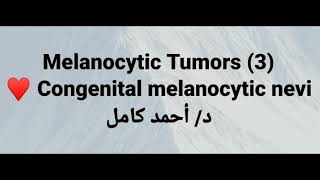 3 congenital melanocytic nevi [upl. by Spiers]