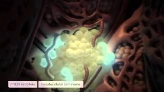 Medical Animation Liver Fibrosis and Cancer Oncology Animation [upl. by Ardekal]