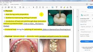 ENDODONTICS ll pulpal and periapical pathosis [upl. by Ayenat]