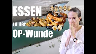 ESSEN in der OPWUNDE nach WeisheitszahnOP WIE geht das wieder RAUS [upl. by Hercule]