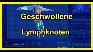 Geschwollene Lymphknoten  Vergrößerte Lymphknoten 2024 [upl. by Sral]