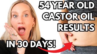 SHOCKING CASTOR OIL RESULTS AFTER 30 Days As a Woman Over 50 [upl. by Kantor]