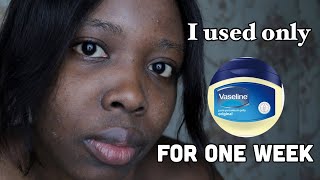 I used only VASELINE on my face everyday for 7 days and this is what happened [upl. by Yroggerg651]