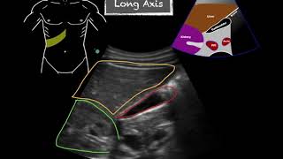 POCUS  Gallbladder Ultrasound Anatomy [upl. by Eidok]