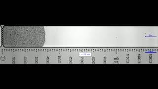 Growth of a yeast clog in a microfluidic chip [upl. by Anaynek219]