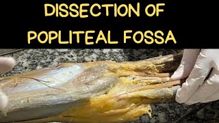 DISSECTION OF POPLITEAL FOSSA [upl. by Ueihtam]