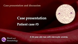 Patient case presentation case 3 [upl. by Elok]