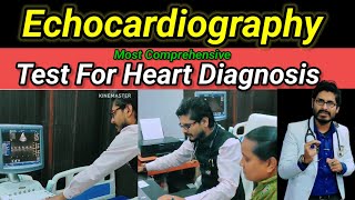 Echocardiography For Heart Diagnosisreels vlog viralvideo video trending explore trend [upl. by Heidy25]