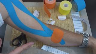 Kinesio Taping Elbow Extension Mobilize Stiff Elbow  Northern Soul channel [upl. by Hett]