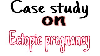 Case study on ectopic pregnancy NCP on ectopic pregnancy ectopicpregnancy [upl. by Aileme279]