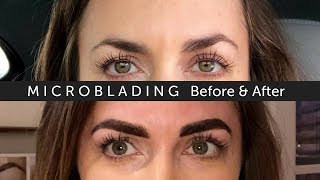 Eyebrow Microblading Experience [upl. by Onailime157]