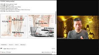 유문 협착증 치유  Healing of Pylorus stenosis [upl. by Raji968]