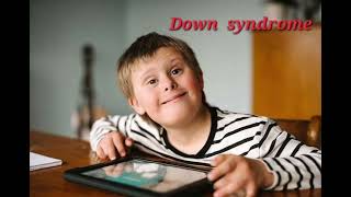 Down syndrome mrcpch Clinical General Examination [upl. by Lertsek]