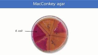 MacConkey agar หลักการ วิธีการอ่านผล  HCU [upl. by Anotyal]