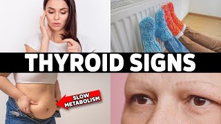 HYPOTHYROIDISM Don’t Ignore These 7 Early Warning Signs [upl. by Goat169]