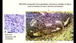 Cancer Stem Cells and Malignant Progression [upl. by Teagan]