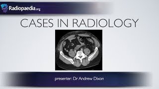 Cases in Radiology Episode 5 trauma CT abdomen [upl. by Adner]