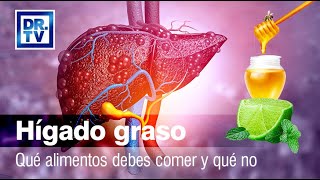 🚩 Hígado graso  Qué alimentos debo comer y qué no  Dieta y consejos 👀👍 [upl. by Seline]