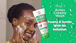 ACNES KENYA  Quickly Clears Pimples [upl. by Ennayd]