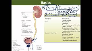 5 Pathology of obstructive uropathy and tumours [upl. by Nivlen]