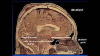 New Developments in the Understanding of Narcolepsy and the Hypocretin system [upl. by Sathrum]