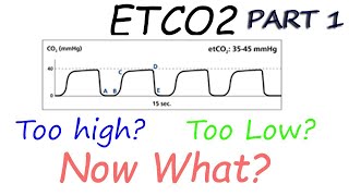 Capnography Waveform Interpretation Etco2 basics explained [upl. by Corrina341]