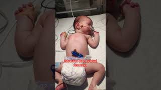 New born baby girl niculife newbornbaby bith retraction by letral nimoniya [upl. by Strawn]