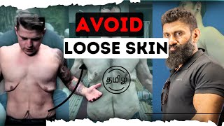 Top 5 Tips to battle loose skin  Biglee Tamil [upl. by Jamin795]