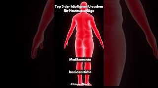 Top 5 der häufigsten Ursachen für Hautausschläge youtubeshorts top5 hautausschläge körper [upl. by Llerref]