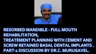 Resorbed mandible full mouth rehabilitation treatment planning cement and screw by DRC MURUGAVEL [upl. by Minette]