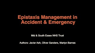 Emergency Epistaxis Management [upl. by Aivalf]