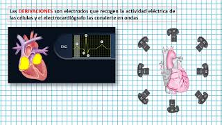 Colocación de las derivaciones del EKG Clases EKG 5 [upl. by Veator210]